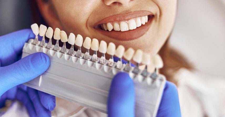 Dental Veneers at Jamnagar