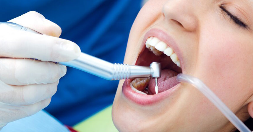 Tooth Colored Filing at Jamnagar