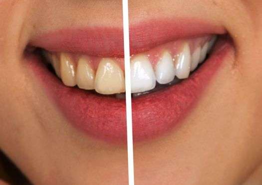 Jamnagar Dental Care Center Transform Your Smile with Modern Restorative Solutions