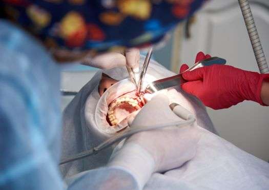 Jamnagar Dental Care Center Advanced Dental Surgeries and Specialized Care in Jamnagar